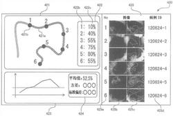 电子内窥镜用处理器以及电子内窥镜系统