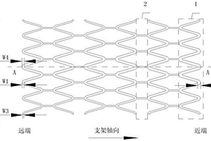 非对称式的血管支架