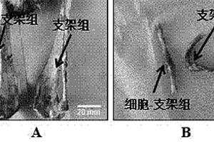 用于骨缺损治疗和修复的细胞-支架复合材料制备方法及其应用