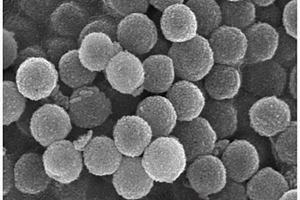 核/壳型纳米银基复合材料及其制法与抗菌应用
