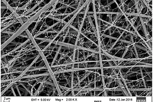 甲壳素晶须/壳聚糖纳米纤维双重增强生物降解聚酯纤维复合材料及其制备方法与应用
