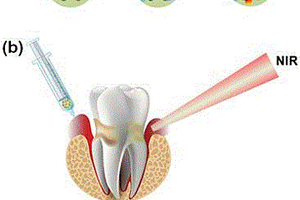 介孔硅负载氮掺杂石墨烯纳米复合材料在制备光热治疗牙周炎药物上的应用及制备方法