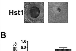 组胺素1多肽在制备促进大面积皮肤缺损修复的复合材料中的应用