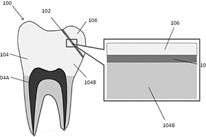 用于牙齿结构的媒介物和制备用于牙齿结构的媒介物的方法