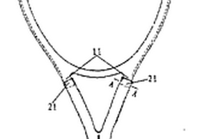 网球拍框架改良结构
