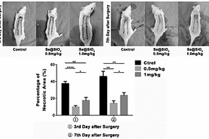 Se@SiO<Sub>2</Sub>纳米硒核壳材料在皮瓣移植术中的应用