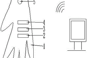 输液用WIFI手套