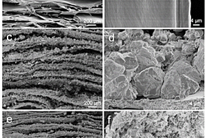 羟基磷灰石/壳聚糖复合材料及其制备方法和应用