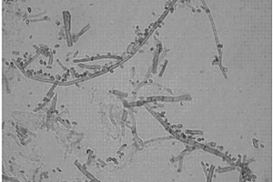 枝孢菌株及其微生物菌剂以及制备方法和应用