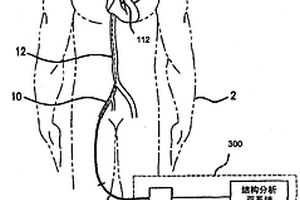 用于进行血管内结构分析以补偿化学分析模态的系统和方法