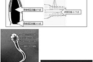 非侵入性精子形态和超微结构分析方法