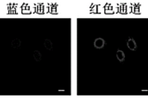 检测溶酶体内生物硫醇的荧光探针及其制备方法和应用