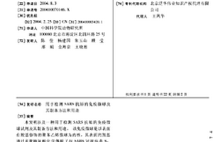 用于检测SARS抗原的免疫微球及其制备方法和用途