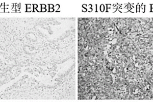 ERBB2 S310F突变的抗体在制备诊断检测胆囊癌中的应用