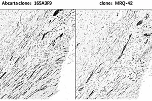 抗CD56重组兔单克隆抗体及其应用