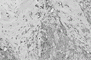 鼠抗人BRAF V600E突变蛋白单克隆抗体制备及其免疫组化用途