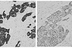 抗CK17蛋白单克隆抗体及其细胞株、制备方法和应用