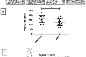 NUDT21基因在制备治疗肺癌药物中的应用
