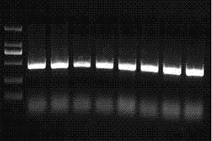小鼠黄嘌呤氧化酶转录水平定量用PCR引物组合及PCR方法