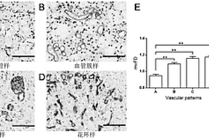 组织微血管分形维数的计算方法