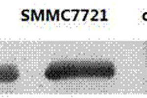 人泛素偶联酶UbcH10单克隆抗体杂交瘤DY03及单克隆抗体