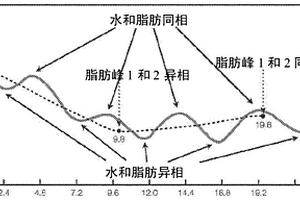 磁共振成像的改进