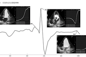 运动员心脏左室内相对压力无创测量方法